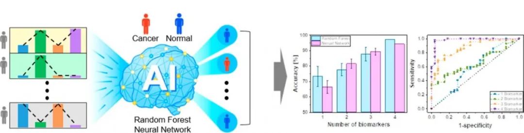 前列腺癌诊断最新突破 AI 尿检大显神通