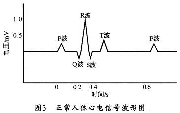 正常人体的心电信号波形图